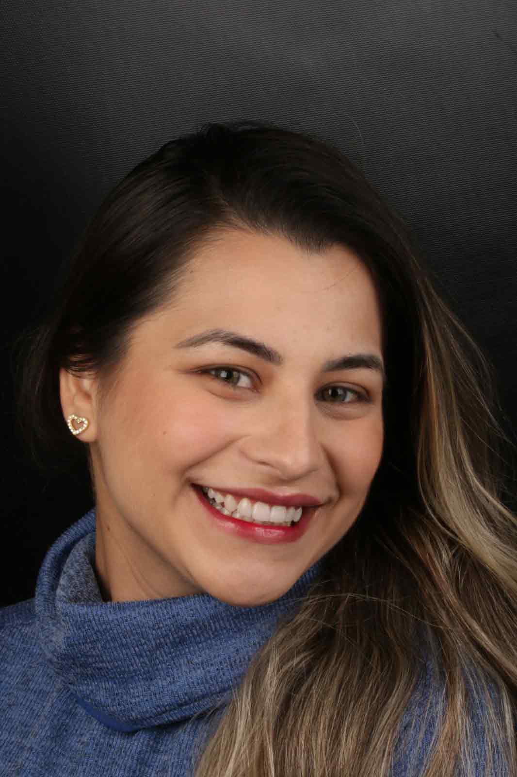 Fernanda - Facetas em Resina