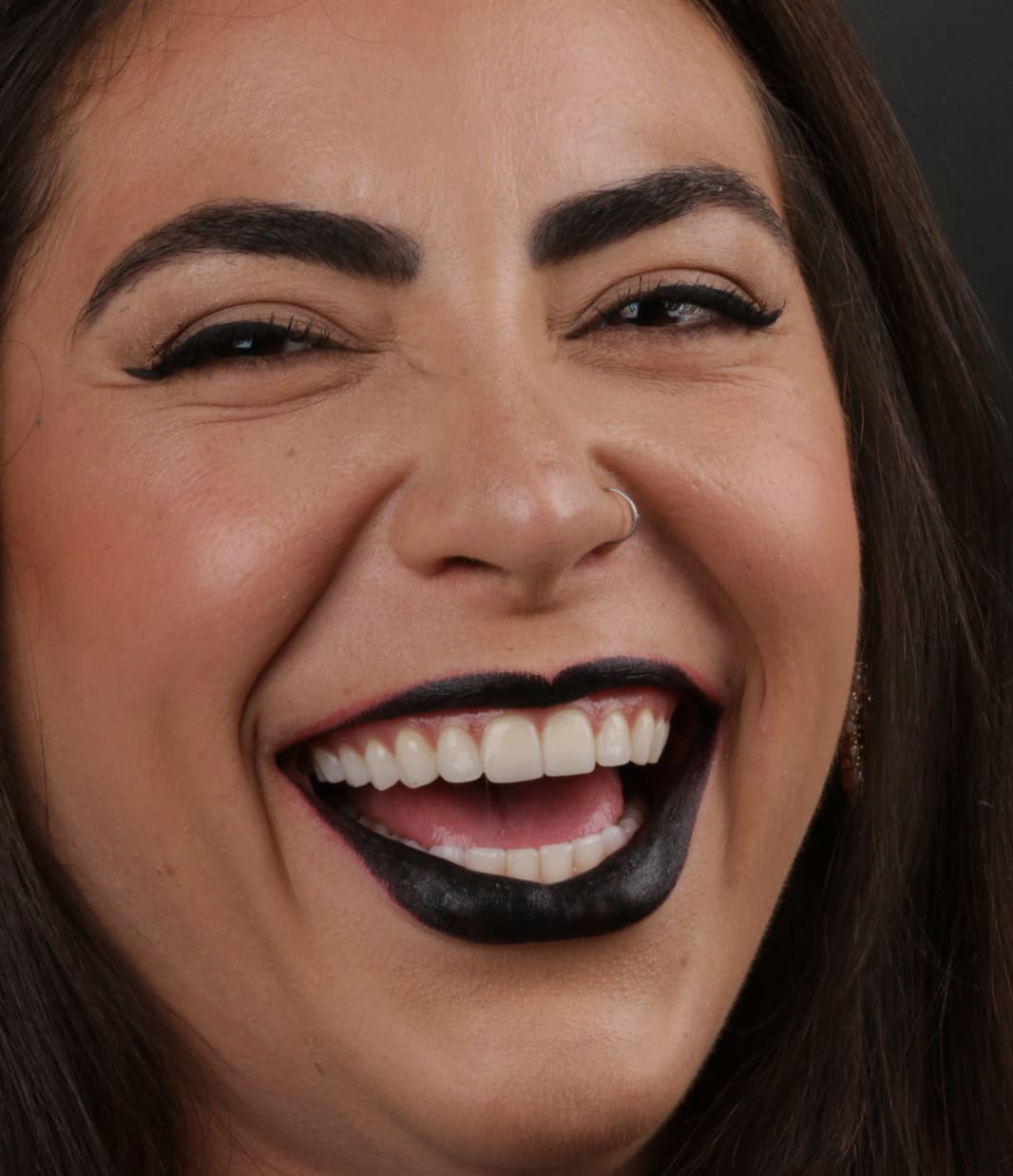 Kahoanna - Facetas em Resina